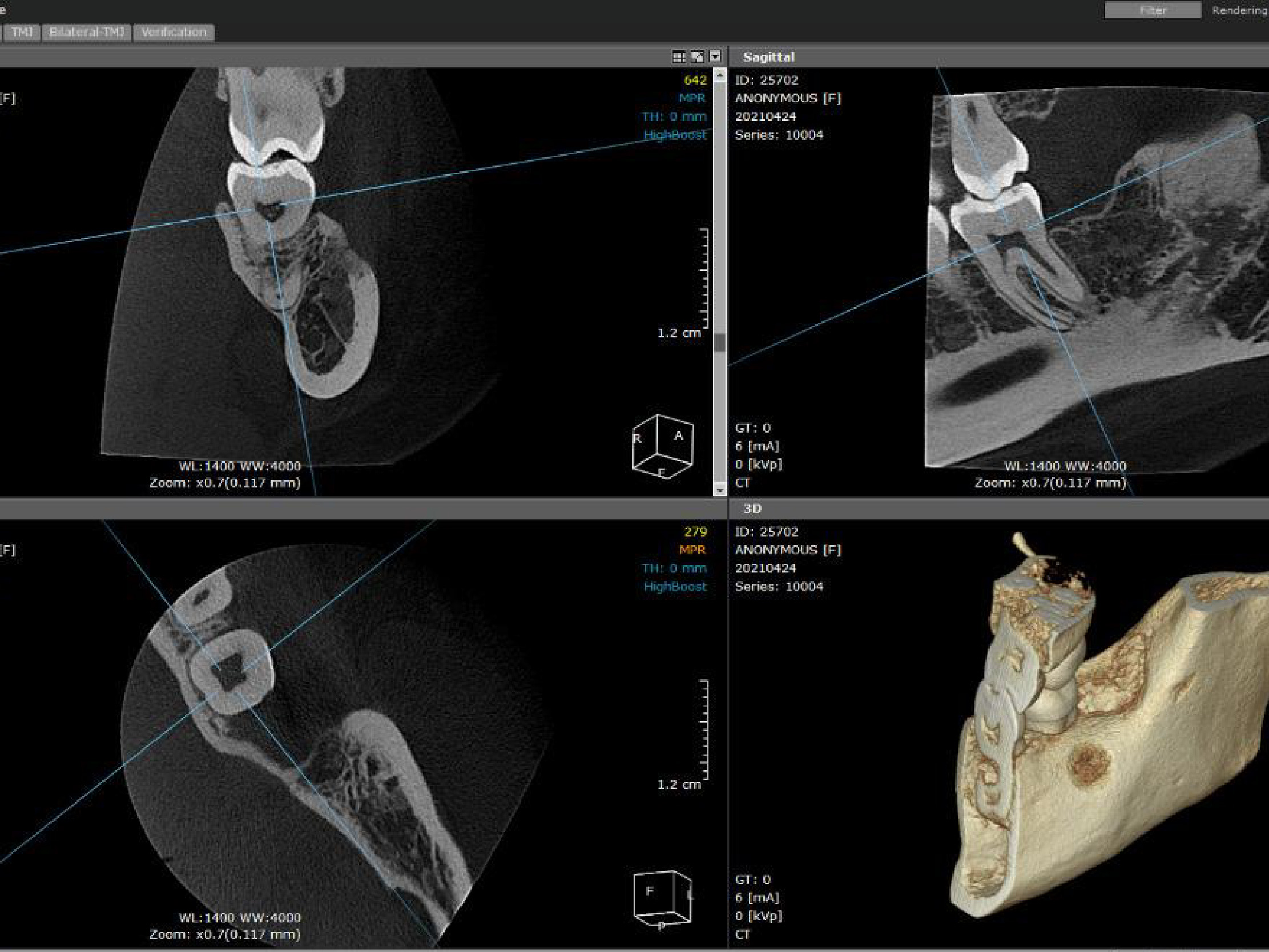 Secciones Transversales